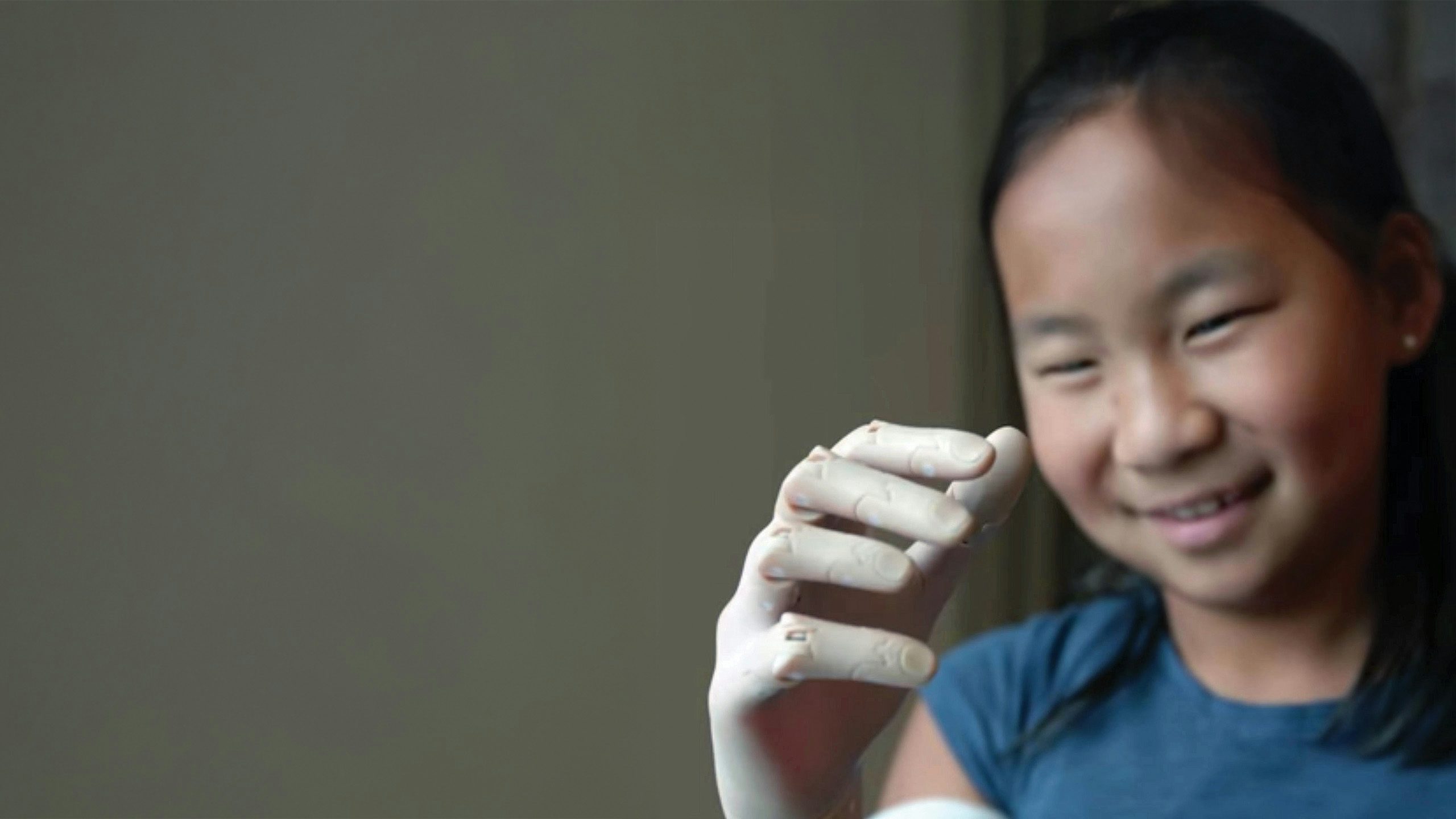 revolution-in-prosthetics-shero-2560x1440